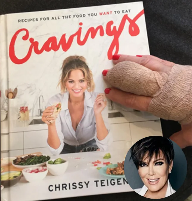 Kris Jenner faz cirurgia na mão e aparece de atadura