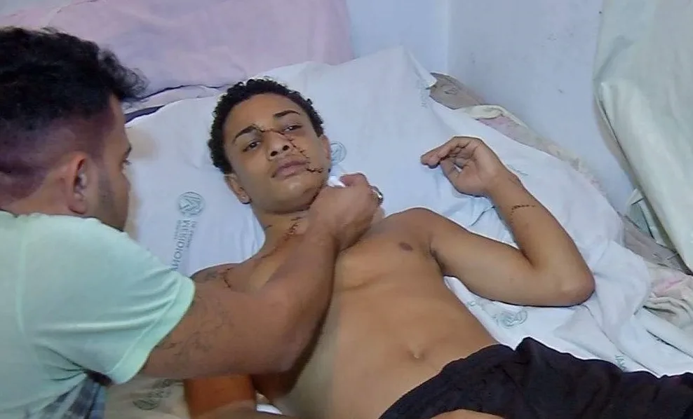 'Foi em legítima defesa', afirma jovem suspeito de ferir rosto de rapaz com estilete em Vitória