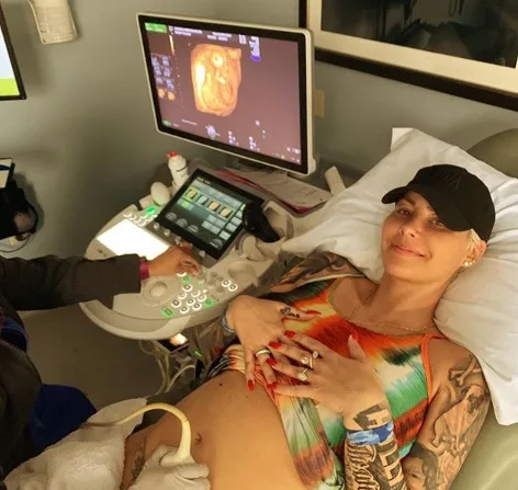 Amber Rose anuncia segunda gravidez