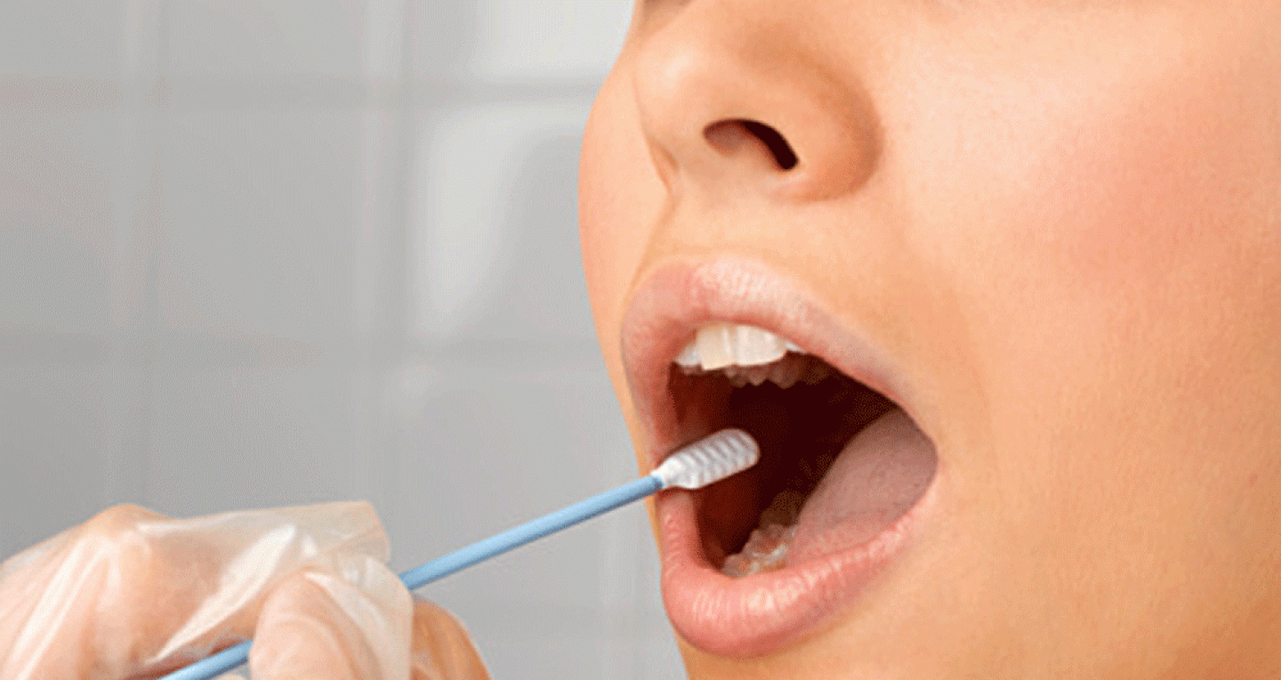 Coronavírus: teste de saliva identifica pacientes assintomáticos