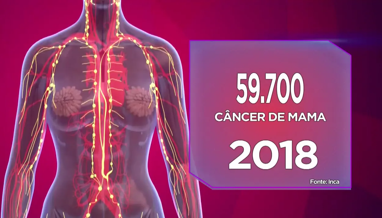 Estudo liga 12% das mortes por câncer de mama à falta de atividades físicas