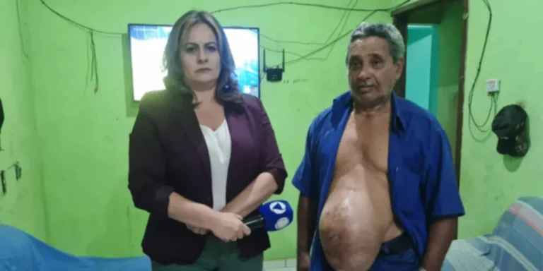 Aposentado convive com hérnia do tamanho de melancia há anos. Foto: Conexão Justiça