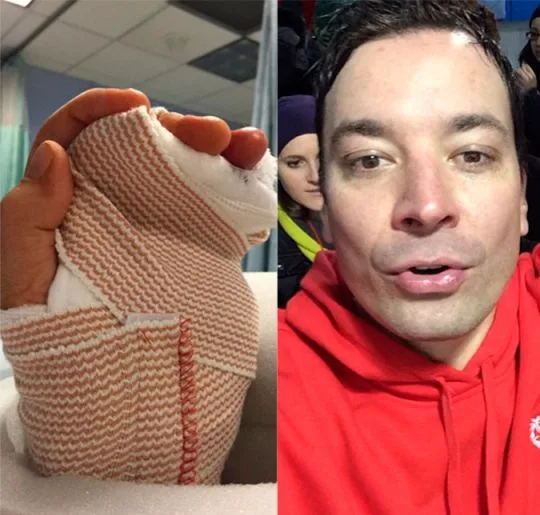 Jimmy Fallon revela como sofreu acidente na mão