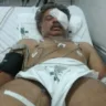 Acusado de esfaquear jovens no Terminal de Vila Velha recebe alta