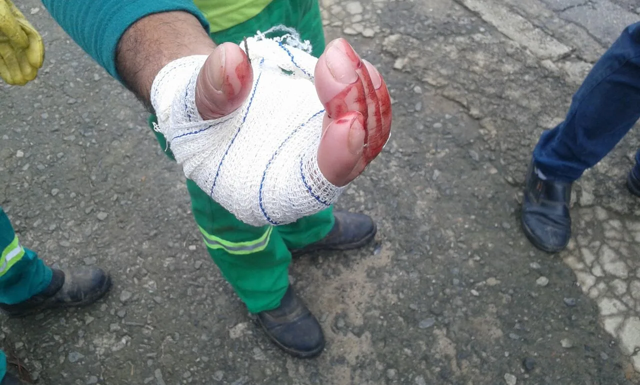 Gari tem mão cortada por cacos de vidro durante coleta de lixo em Cariacica