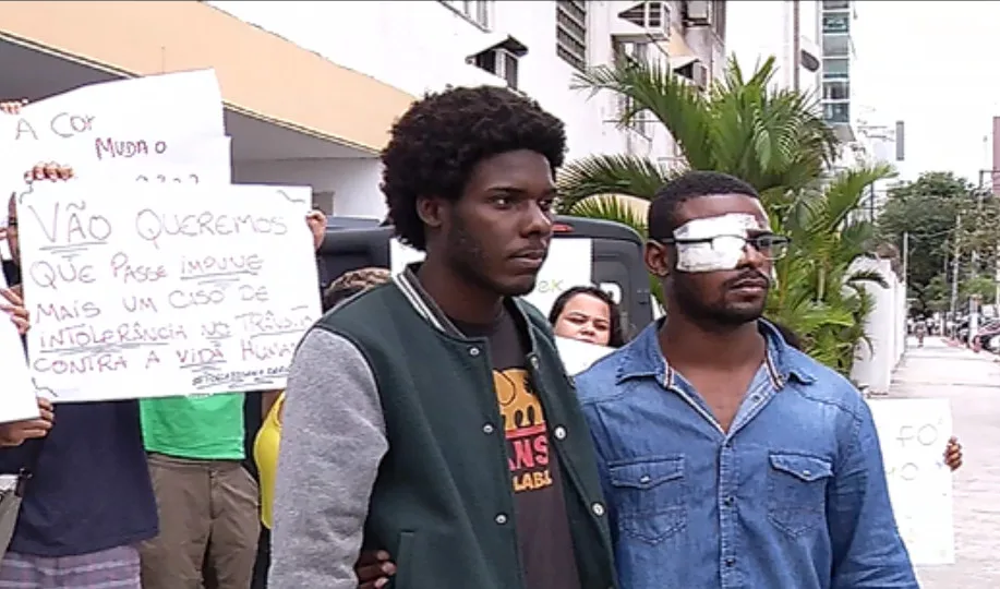 Parentes e amigos de jovem baleado no olho fazem protesto na DHPP