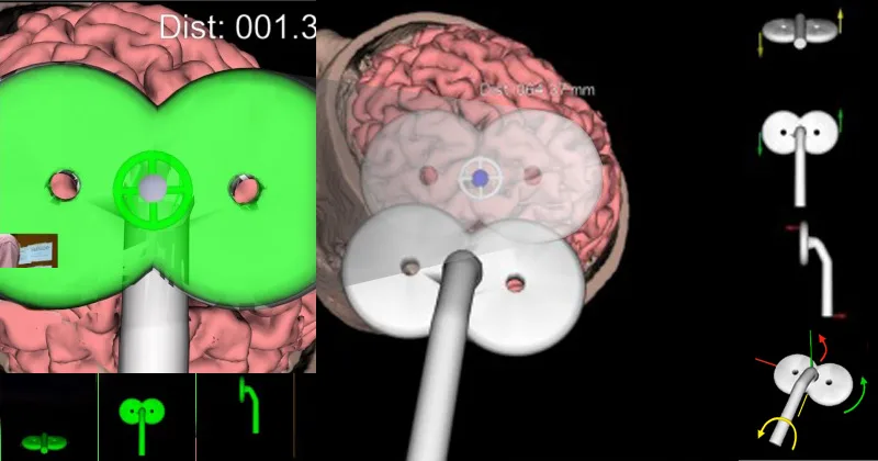 Pesquisadores desenvolvem software livre para navegar pelo cérebro