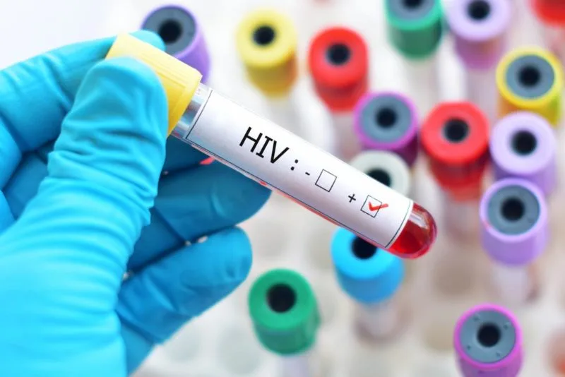 Universidade brasileira relata tratamento que elimina HIV de paciente