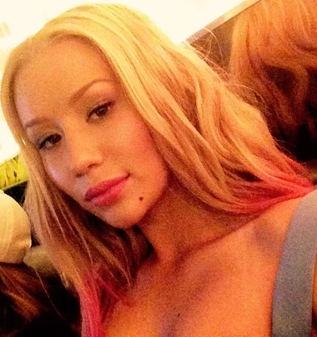 Iggy Azalea mostra plástica no nariz e queixo durante premiação, diz revista