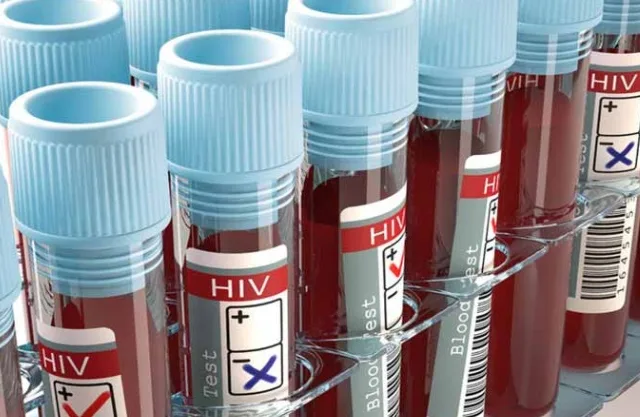 Anvisa aprova registro do primeiro teste de farmácia para diagnóstico de HIV