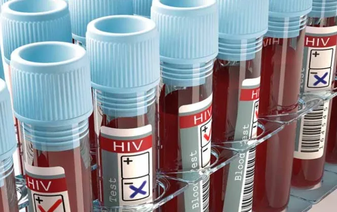 Anvisa aprova registro do primeiro teste de farmácia para diagnóstico de HIV
