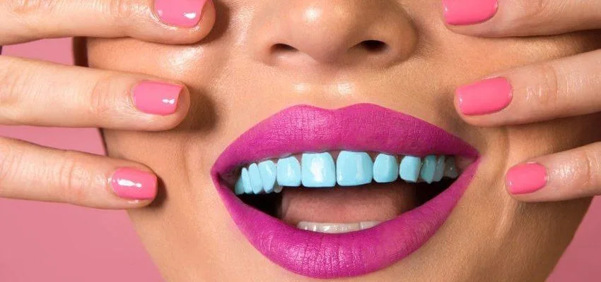 Esmalte colorido no dente é tendência perigosa, alerta especialista