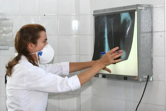 Cidades com extrema desigualdade sofrem mais com tuberculose