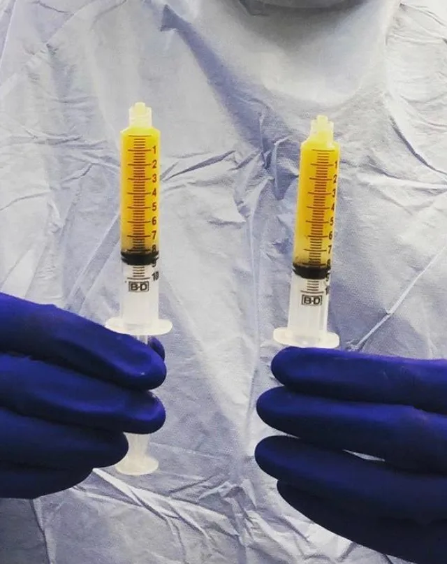 Pela primeira vez no Brasil: tratamento reparador de células será realizado no ES nesta semana