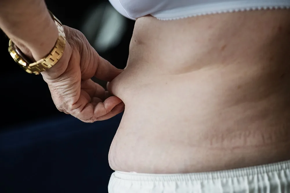 Closeup of obese elderly woman