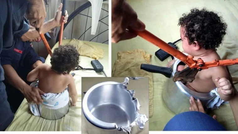 Bebê fica presa em panela de pressão e é resgatada pelos bombeiros no Acre