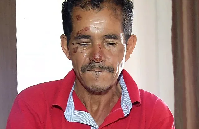 Vendedor de picolé atropelado na Praia da Costa diz que nasceu de novo