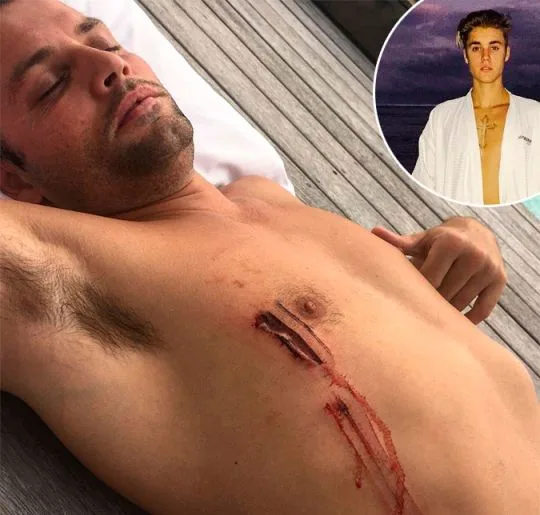 Justin Bieber escapa de ataque de tubarão na Austrália