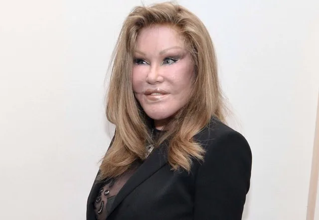 Jocelyn Wildenstein é presa acusada de atacar namorado