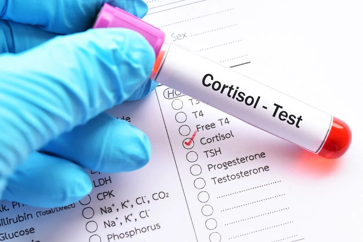 Cortisol alto: o que pode ser, sintomas (como baixar e melhorar)