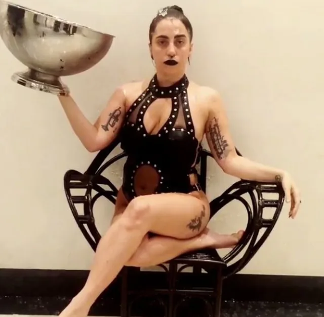 Lady Gaga revela que sofre de dores crônicas e recebe apoio de seguidores