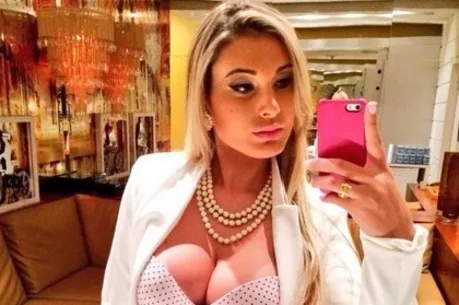 Ainda internada, Andressa Urach reclama de fortes dores na perna