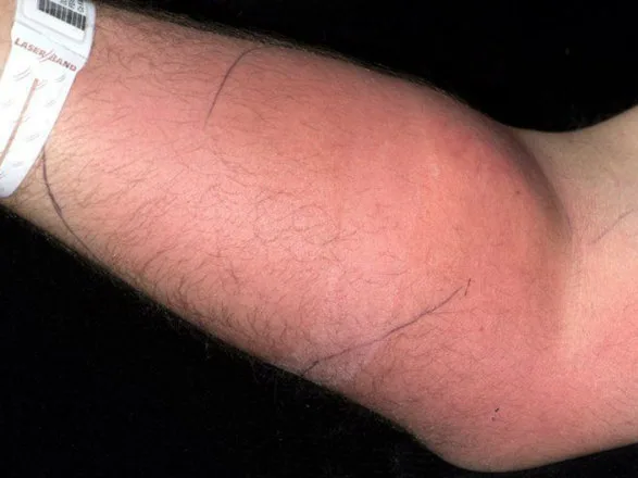 Foto: Reprodução/Irish Medical Journal