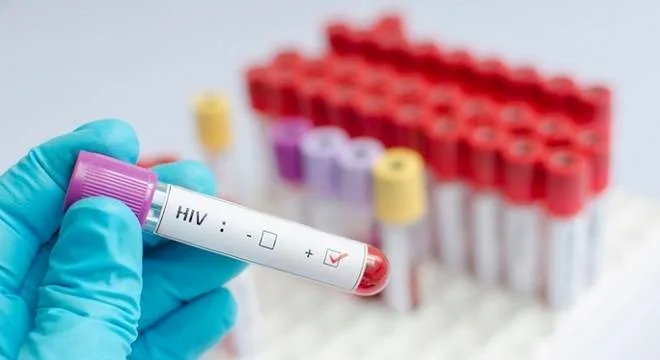 Aumenta o número de notificações de casos de HIV no ES