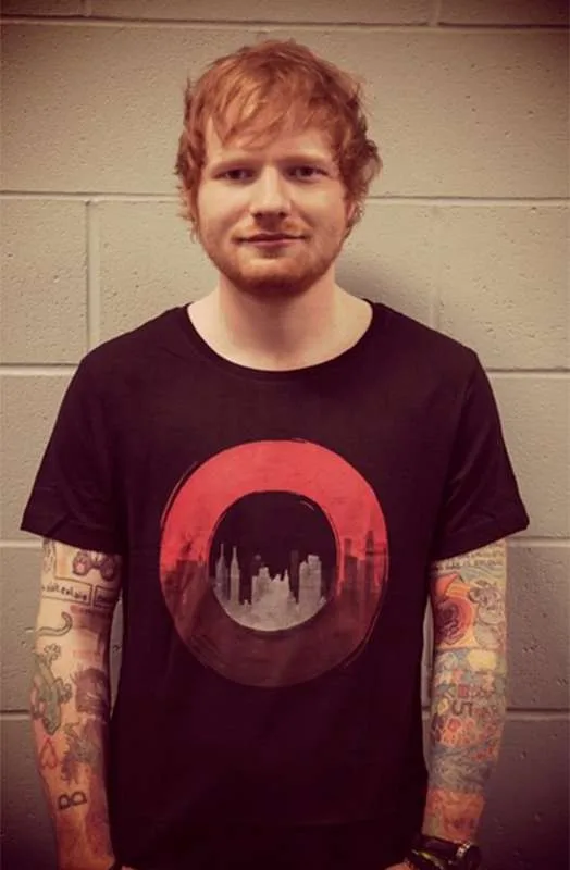 Ed Sheeran surpreende fã com doença rara