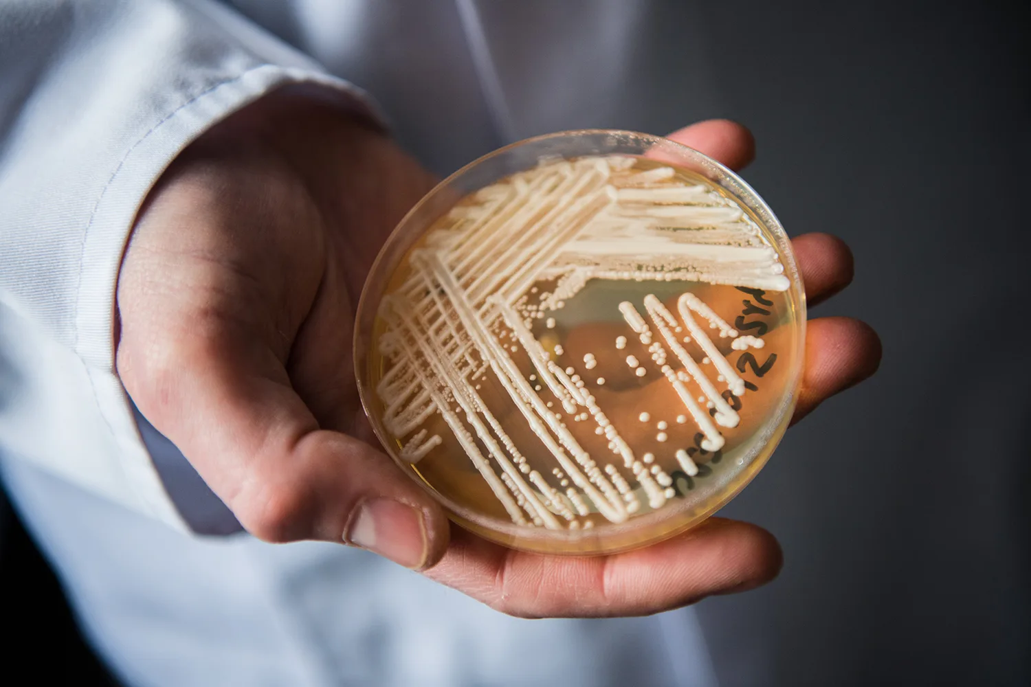 The director of the National Reference Centre for Invasive Fungus Infections, Oliver Kurzai, holding in his hands a petri dish holding the yeast candida auris in a laboratory of Wuerzburg University in Wuerzburg, Germany, 23 January 2018. There has been a recent rise of cases in Germany of seriously ill patients becoming infected with the […]