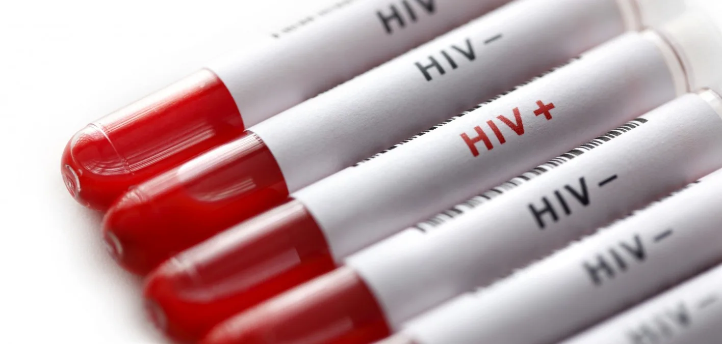 Após falso resultado de HIV, grávida será indenizada em R$ 10 mil no ES