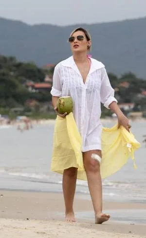 Photo © 2015 The Grosby Group EXCLUSIVE Florianopolis, Jan. 3, 2015. Photos taken in December 2014. These graphic images show Andressa Urach, Miss BumBum 2012 runner up, who had ran the risk of having a leg amputated after a botched cosmetic surgery procedure got infected, while she spent last month in the ICU unit of […]