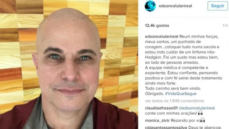 Edson Celulari publica foto careca após ser diagnosticado com câncer