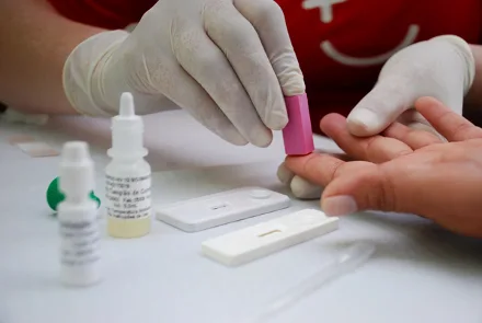 Estado oferece novo tipo de teste de HIV na rede pública