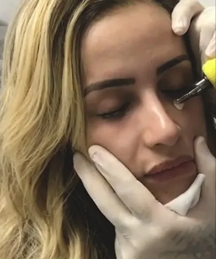 Tatuagem para cobrir olheiras: dermatologista explica a técnica e faz um alerta