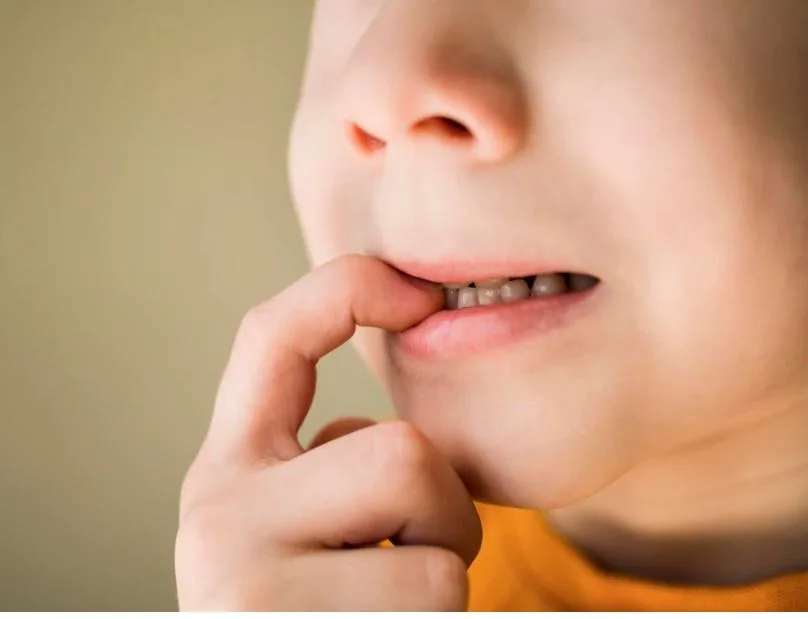 Não há espaço para nascer o dente permanente? Saiba o que fazer