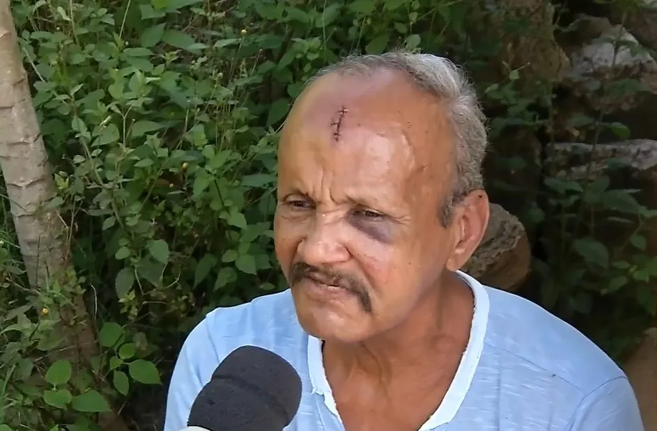 'Achei que fosse morrer', desabafa idoso agredido pelo filho que diz 'ouvir vozes'