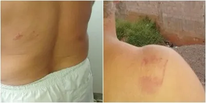 Motorista é surpreendido por homem e agredido em Cachoeiro de Itapemirim