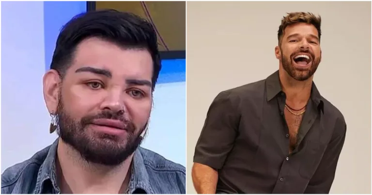 Ator argentino faz mais de 30 cirurgias para se parecer com Ricky Martin e quase perde a visão