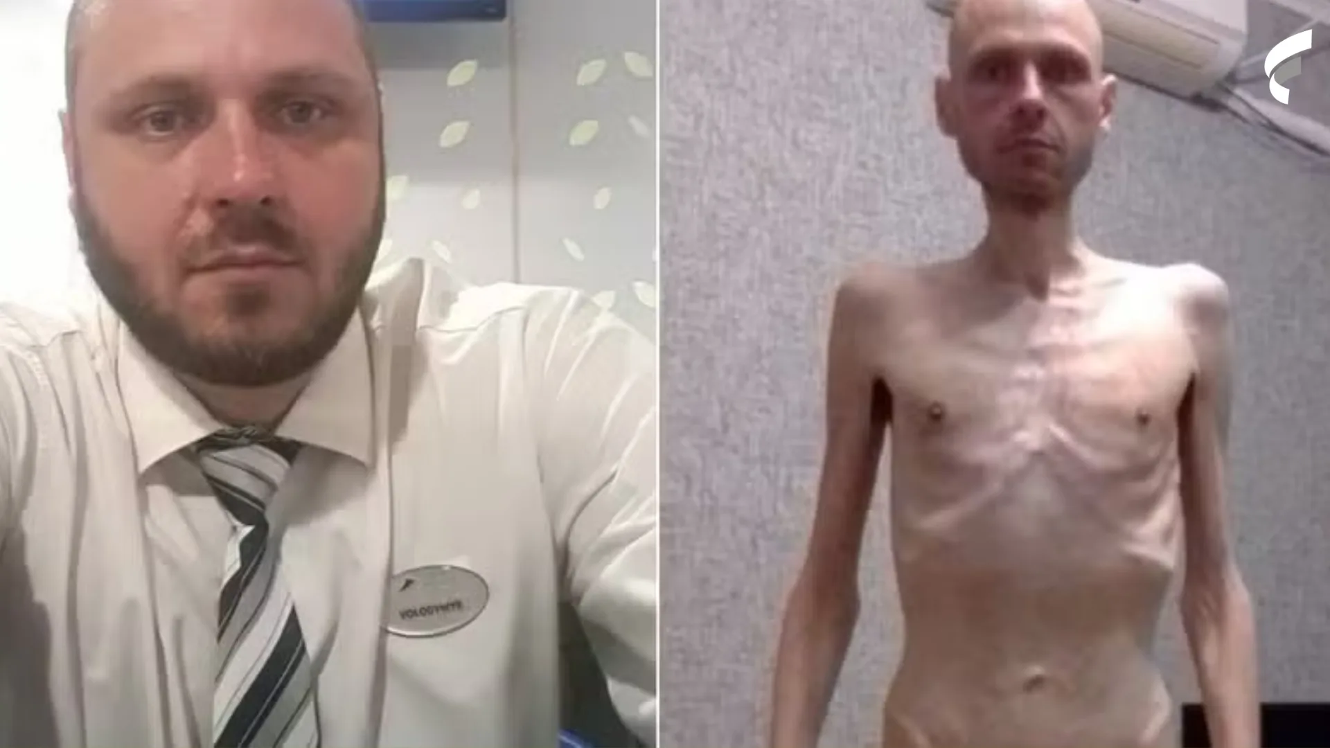 Refém da Rússia: com 1,91 m e 57 kg, foto de antes e depois de militar preso impressiona