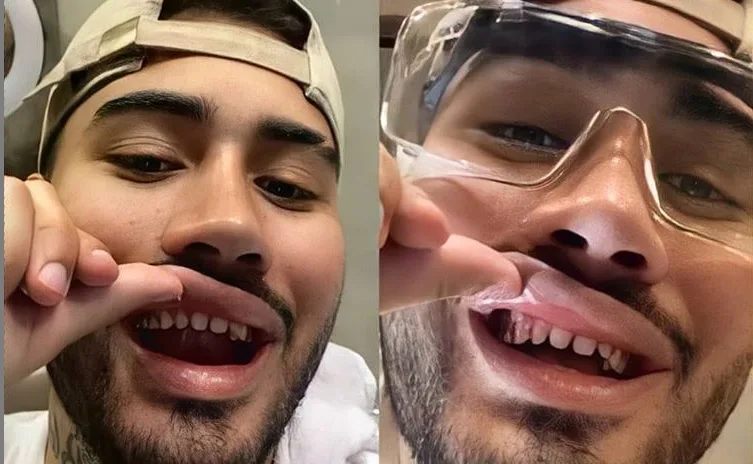 Kevinho exibe dentes sem lentes de contato e vira piada nas redes sociais