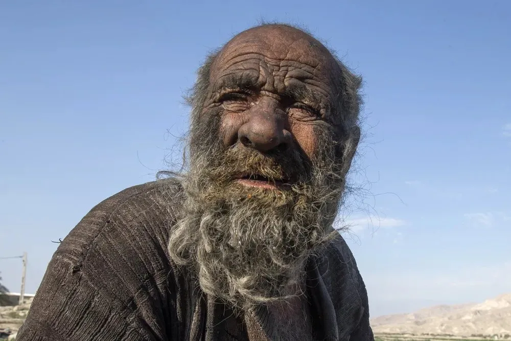 "Homem mais sujo do mundo" morre após tomar banho