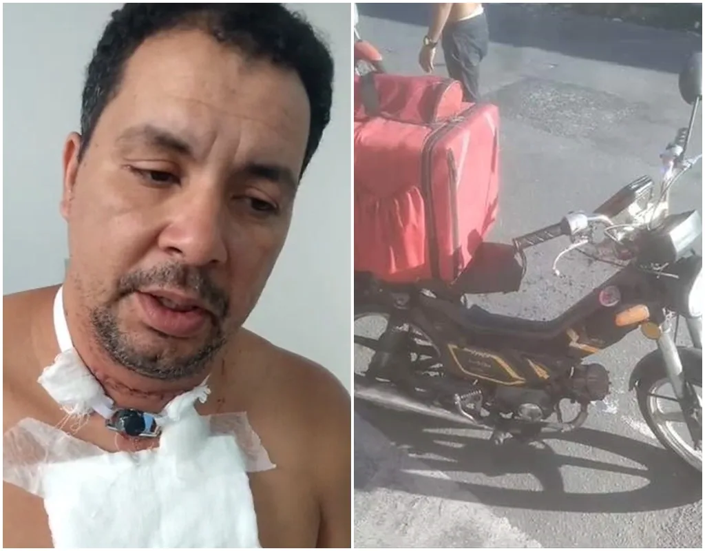 VÍDEO | Motoboy que teve pescoço cortado por linha de cerol recebe alta