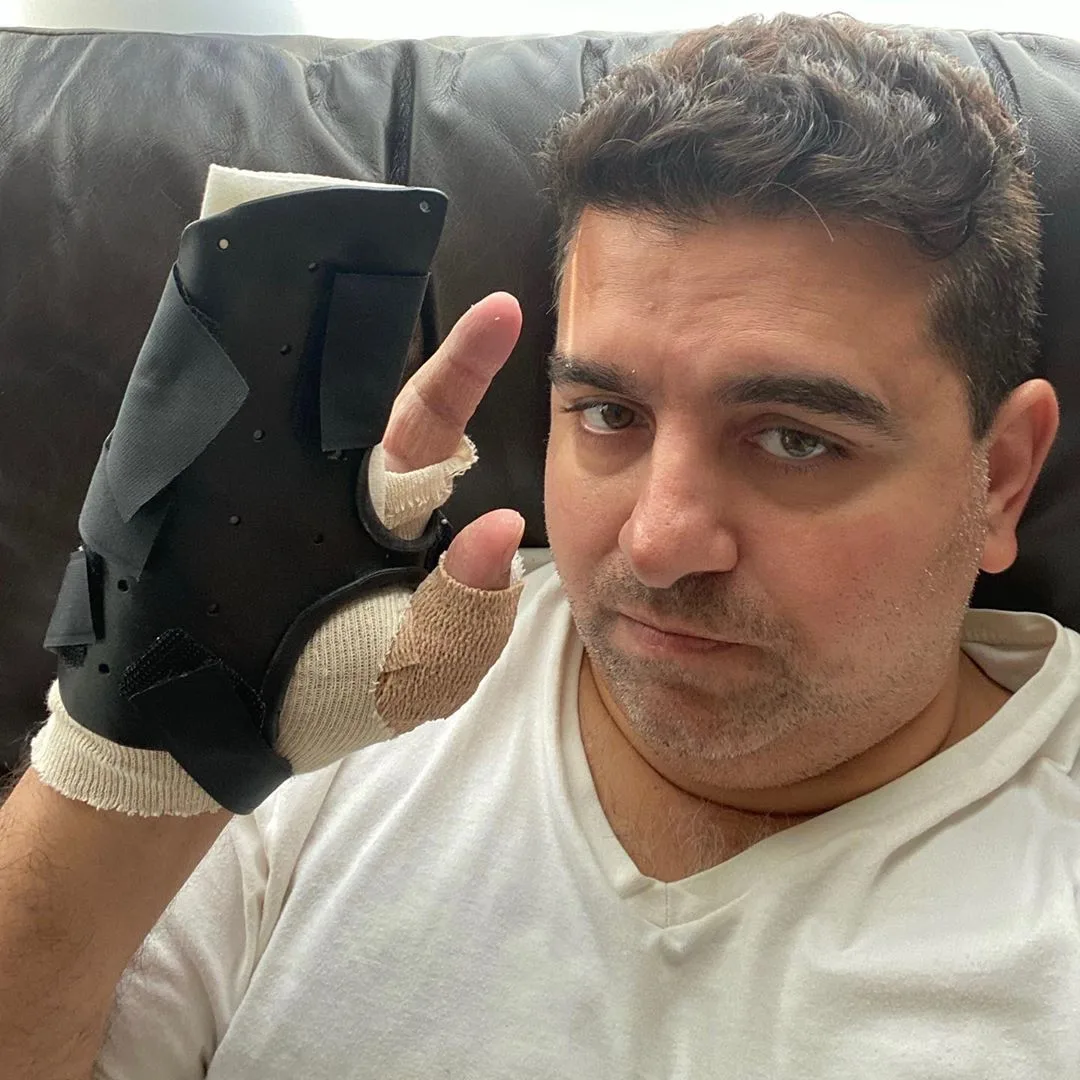 Após acidente, Buddy Valastro passa pela terceira cirurgia na mão: "Tem sido um caminho difícil para a recuperação"