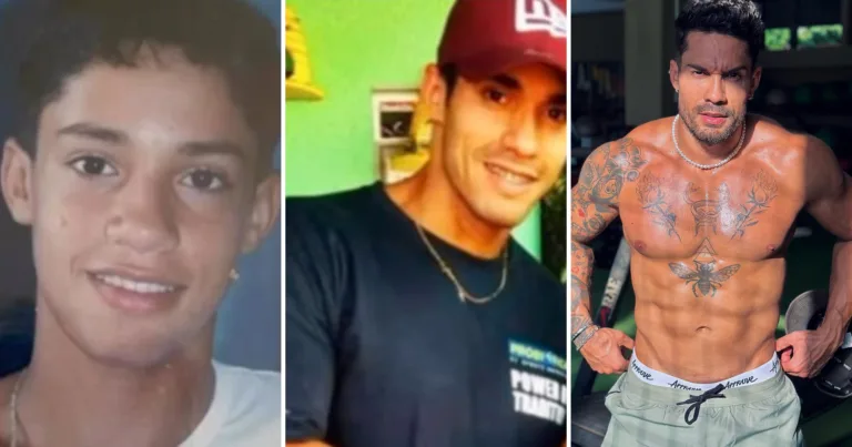 Antes e depois de Bil Araújo viraliza e fãs pedem OnlyFans: "Harmonização"