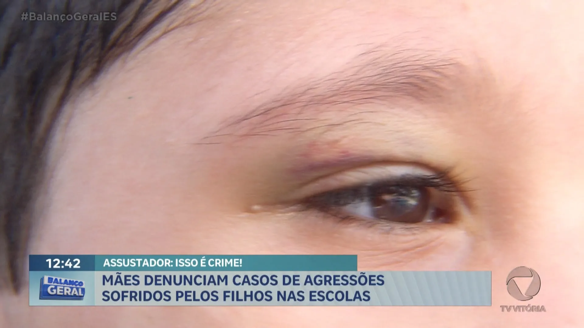 Mães denunciam casos de agressões sofridos pelos filhos nas escolas