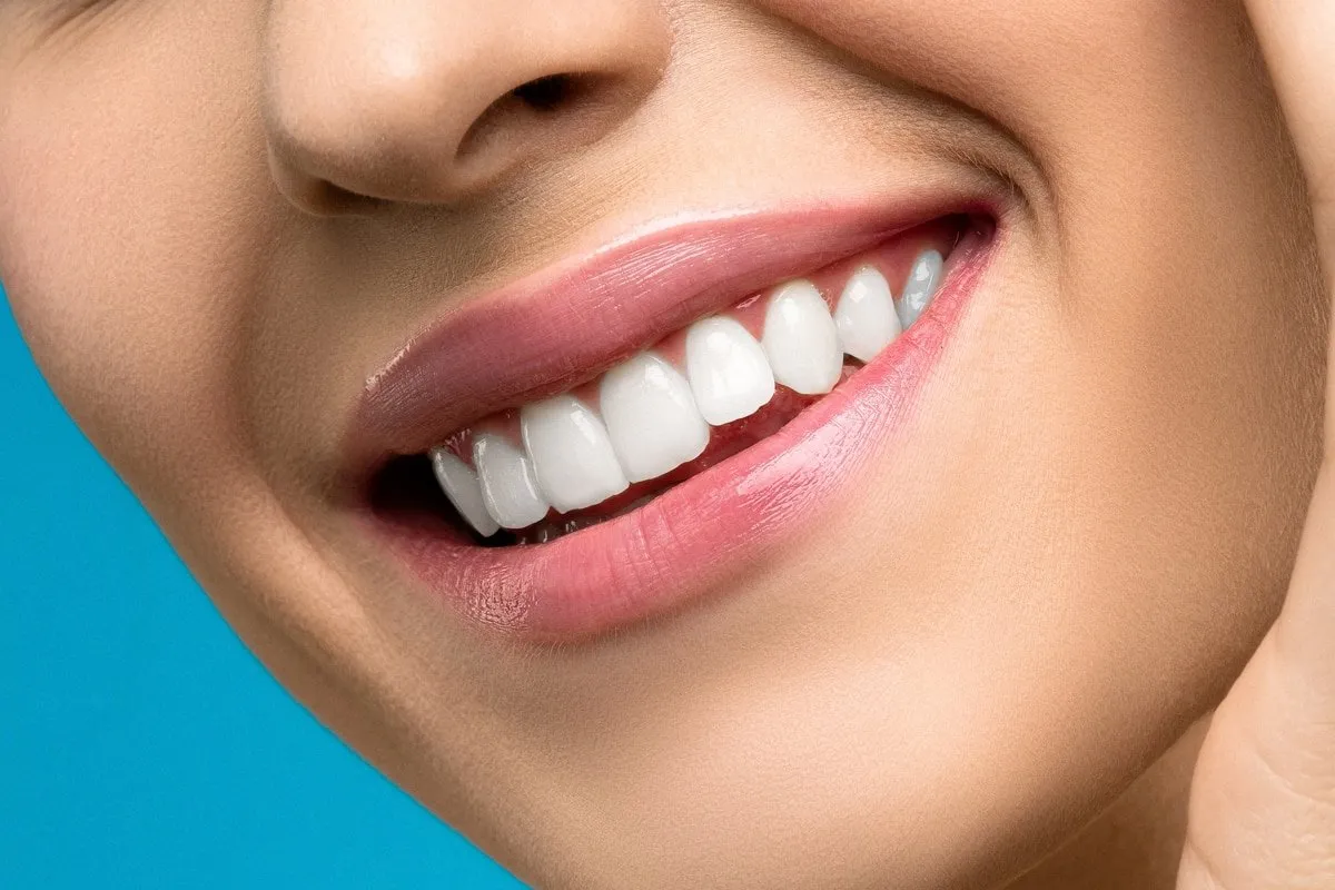 Facetas dentárias: entenda os riscos e recomendações