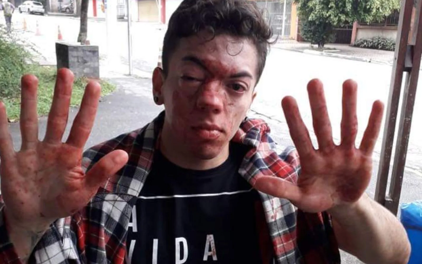 Jovem diz que foi agredido por motorista de ônibus e denuncia homofobia