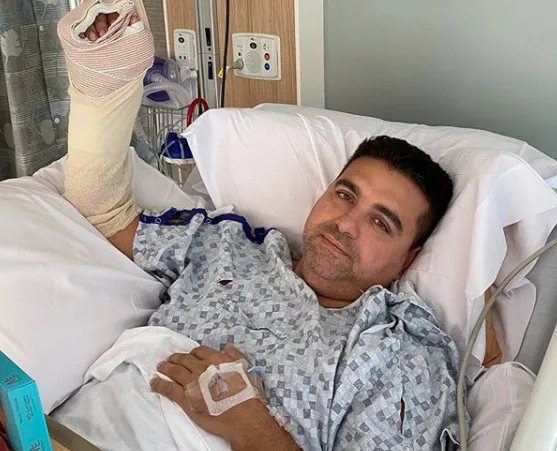 Buddy Valastro detalha acidente que causou cirurgia em sua mão