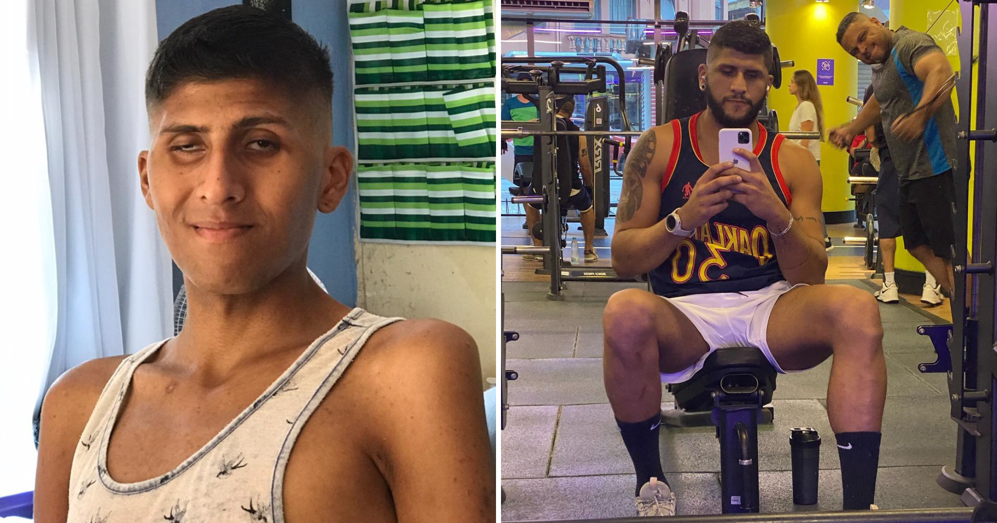 Influencer que ficou cego com Aids posta antes e depois de tratamento do HIV